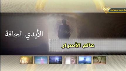  الايدي الجافة